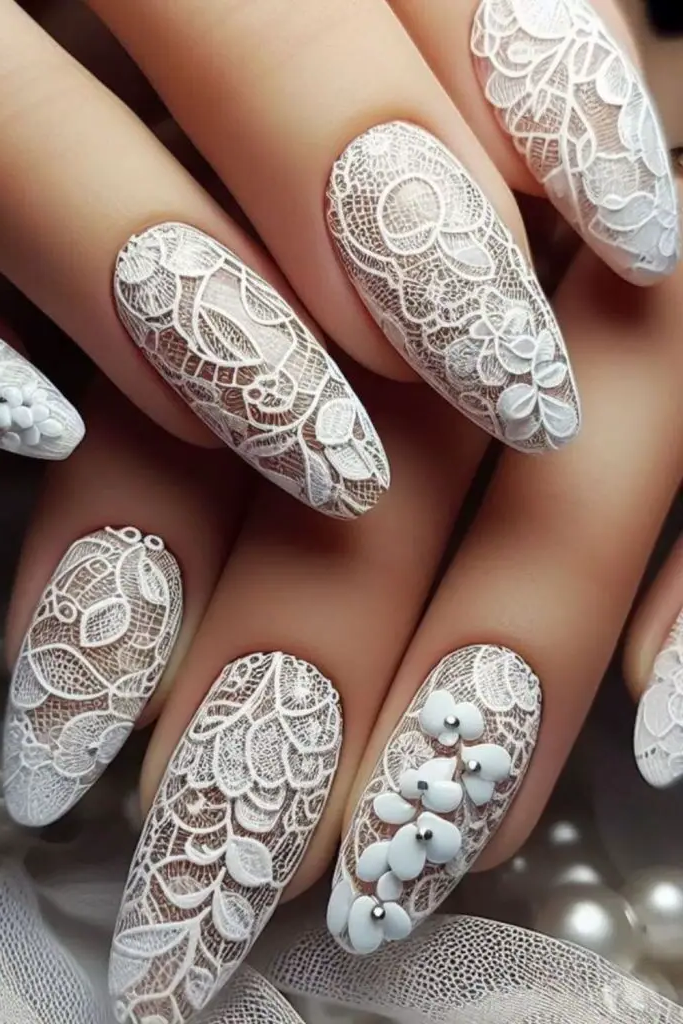 Champagne Gold Nails with White Lace Accents